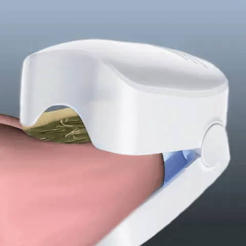 Appareil de traitement au laser pour champignon des ongles